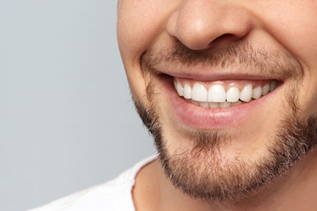 Man smiling showing pearly white teeth