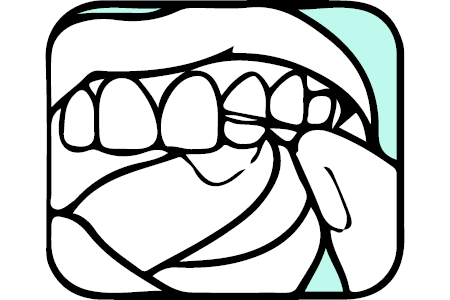 Illustration of dental floss between teeth