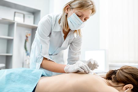 Acupuncturist adding needles to her patients back during an acupuncture appointment